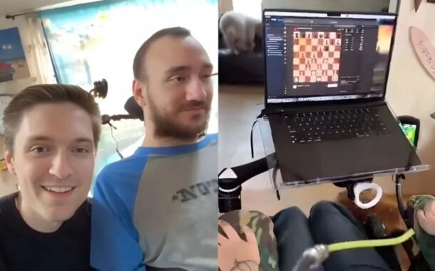 Первый обладатель Neuralink поделился годовым опытом владения нейроимплантом